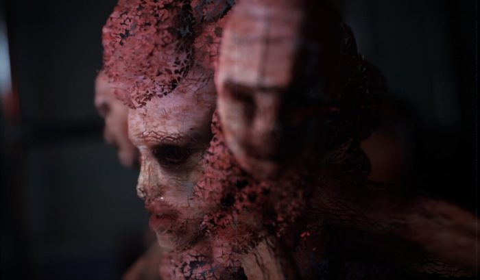 Post Trauma